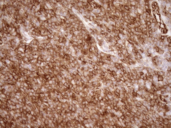 LIMA1 Antibody in Immunohistochemistry (Paraffin) (IHC (P))