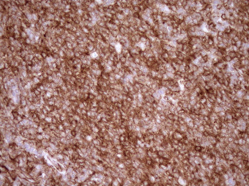 LIMA1 Antibody in Immunohistochemistry (Paraffin) (IHC (P))
