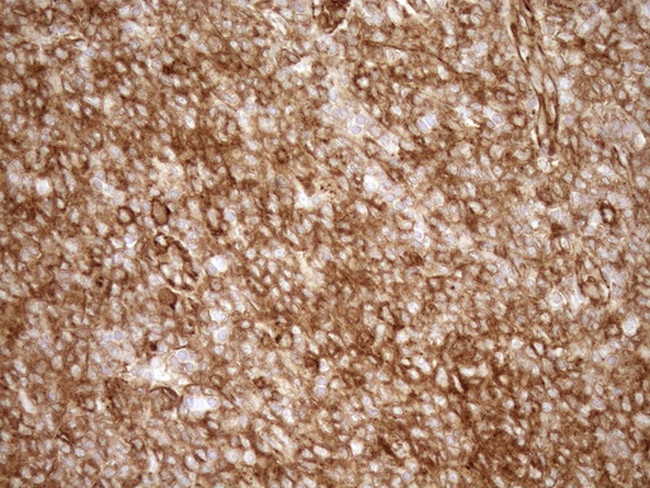 LIMA1 Antibody in Immunohistochemistry (Paraffin) (IHC (P))
