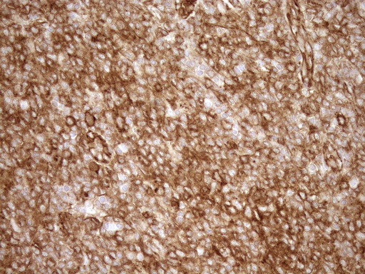 LIMA1 Antibody in Immunohistochemistry (Paraffin) (IHC (P))