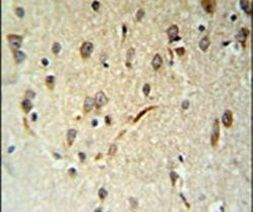 LIMD2 Antibody in Immunohistochemistry (IHC)
