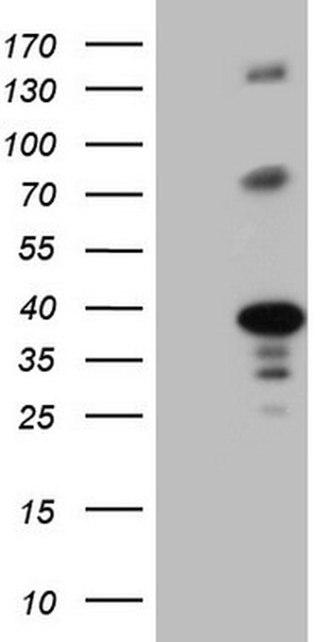 LIME1 Antibody in Western Blot (WB)