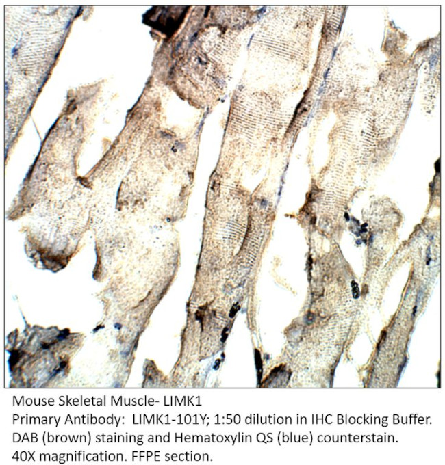 LIMK1 Antibody in Immunohistochemistry (IHC)