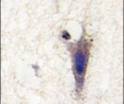 LINGO1 Antibody in Immunohistochemistry (IHC)