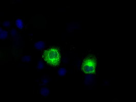 LIPG Antibody in Immunocytochemistry (ICC/IF)