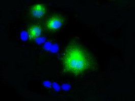 LIPG Antibody in Immunocytochemistry (ICC/IF)