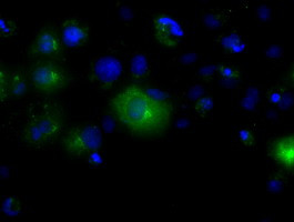 LIPG Antibody in Immunocytochemistry (ICC/IF)