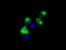 LIPG Antibody in Immunocytochemistry (ICC/IF)