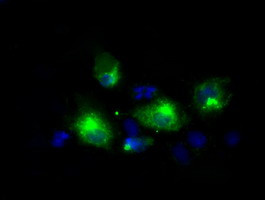 LIPG Antibody in Immunocytochemistry (ICC/IF)