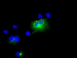 LIPG Antibody in Immunocytochemistry (ICC/IF)