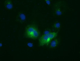 LIPG Antibody in Immunocytochemistry (ICC/IF)