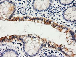 LIPG Antibody in Immunohistochemistry (Paraffin) (IHC (P))