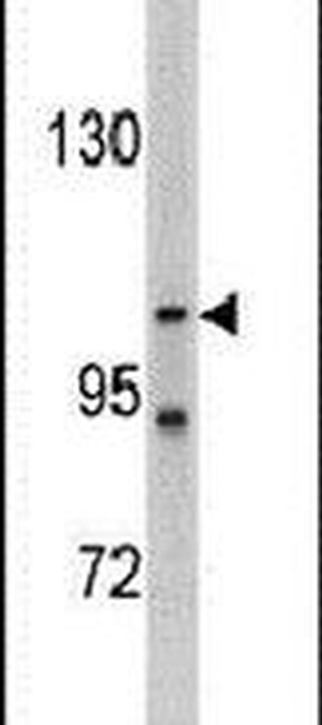 LLGL2 Antibody in Western Blot (WB)