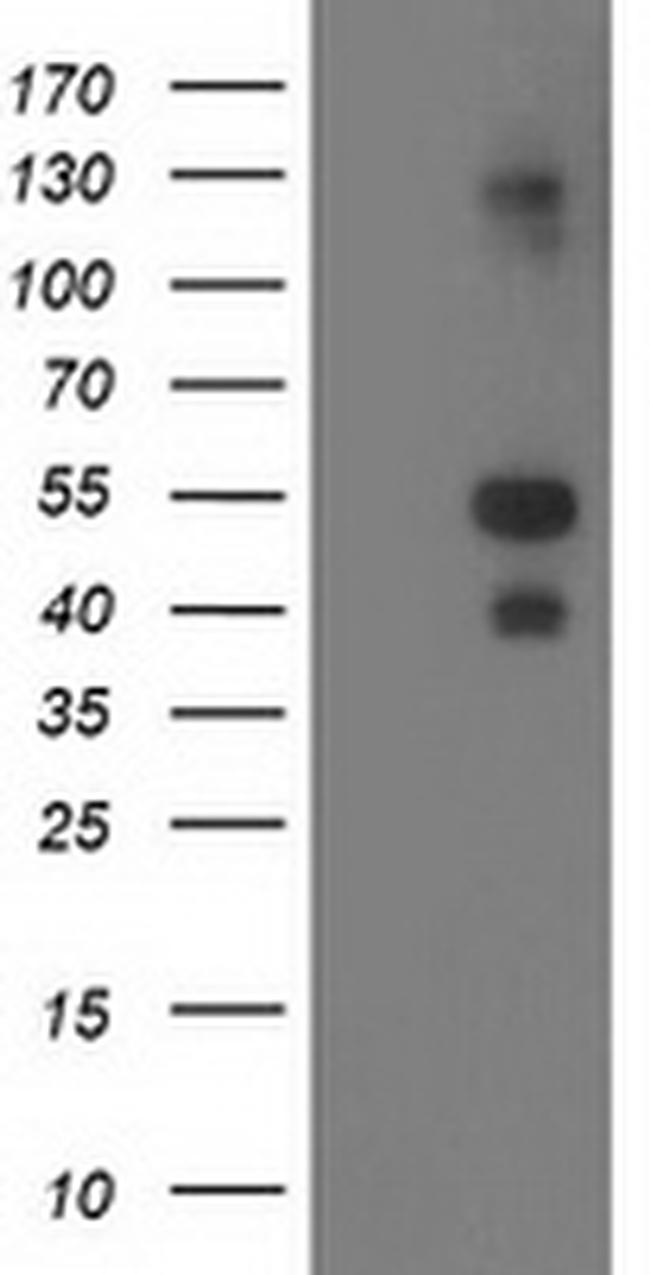 LMCD1 Antibody in Western Blot (WB)