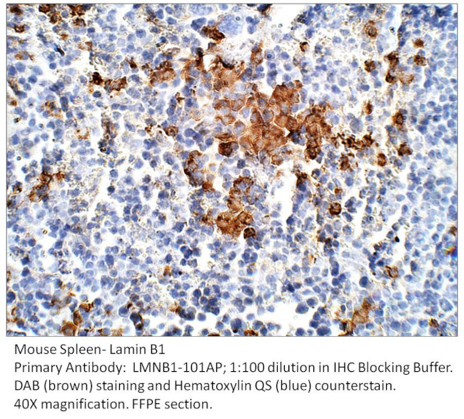 Lamin B1 Antibody in Immunohistochemistry (IHC)