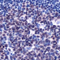 LMO2 Antibody in Immunohistochemistry (IHC)