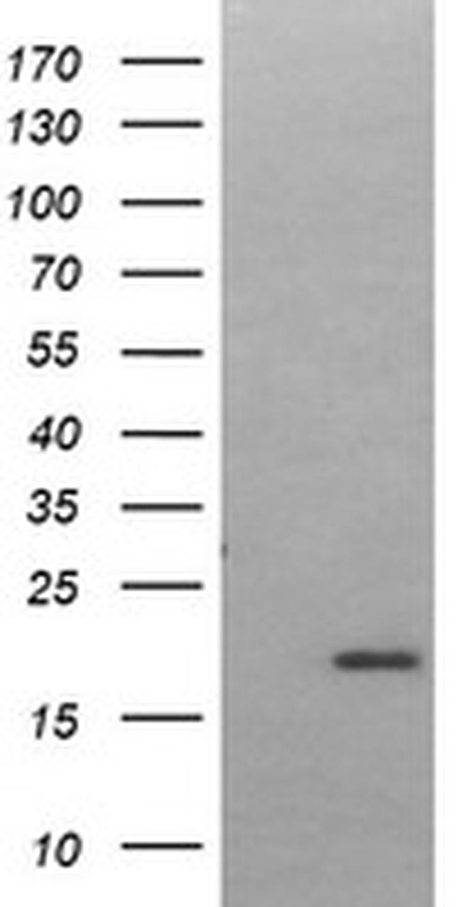 LMO2 Antibody in Western Blot (WB)