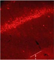 Glycine Binding Protein Antibody in Immunohistochemistry (IHC)