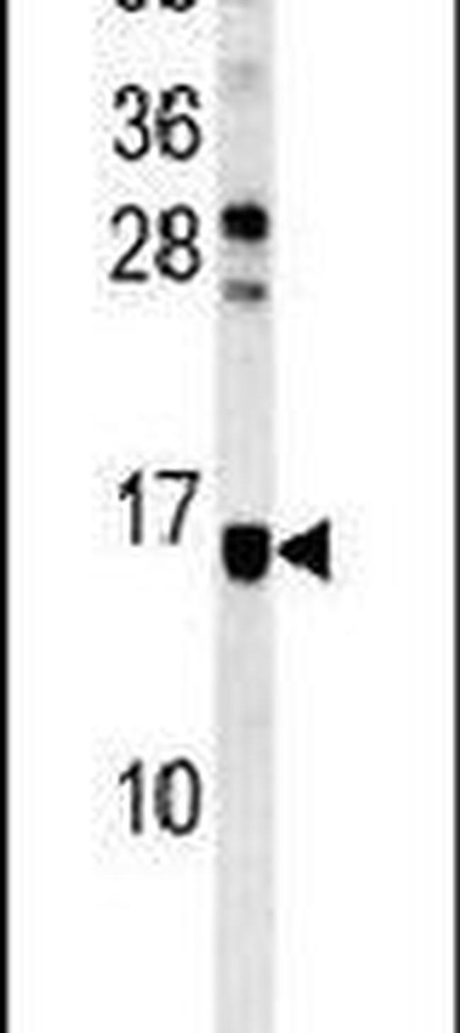 ATXN7L3B Antibody in Western Blot (WB)