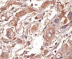 LOK Antibody in Immunohistochemistry (IHC)