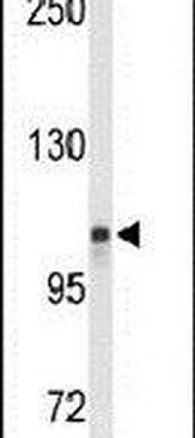 LONP2 Antibody in Western Blot (WB)