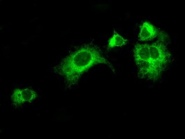 LOX Antibody in Immunocytochemistry (ICC/IF)