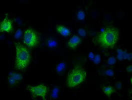 LOX Antibody in Immunocytochemistry (ICC/IF)