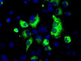 LOX Antibody in Immunocytochemistry (ICC/IF)