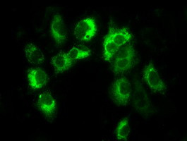 LOX Antibody in Immunocytochemistry (ICC/IF)