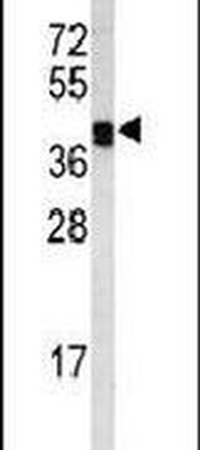LOX Antibody in Western Blot (WB)