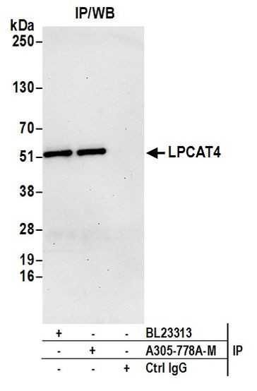 LPCAT4 Antibody in Immunoprecipitation (IP)
