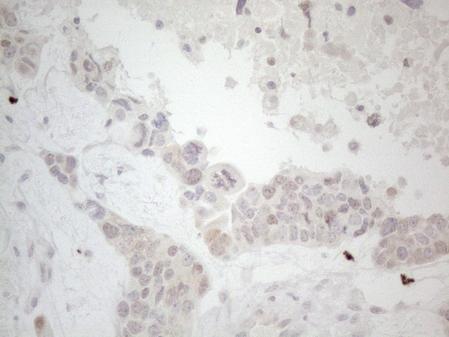 LPIN1 Antibody in Immunohistochemistry (Paraffin) (IHC (P))