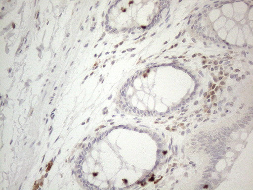 LPIN1 Antibody in Immunohistochemistry (Paraffin) (IHC (P))