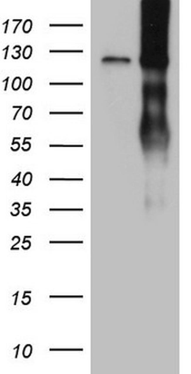 LPIN1 Antibody in Western Blot (WB)