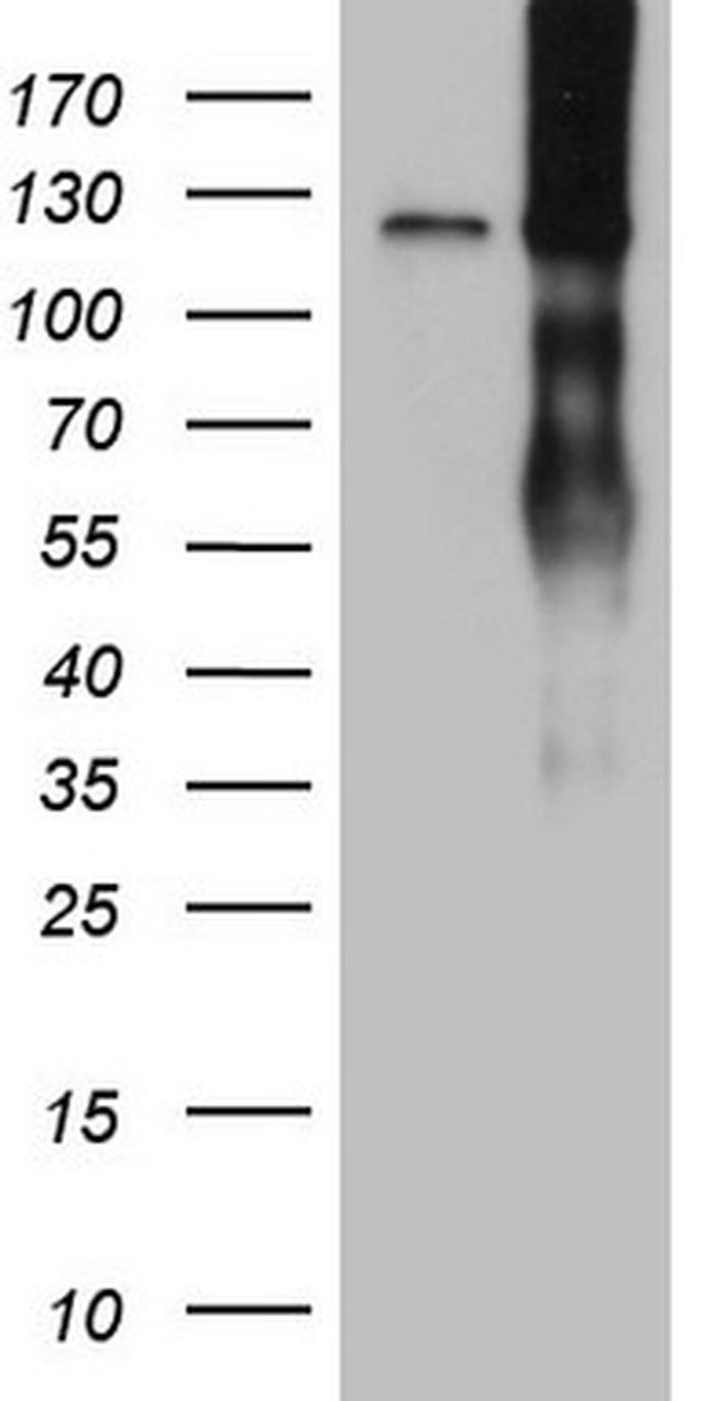 LPIN1 Antibody in Western Blot (WB)