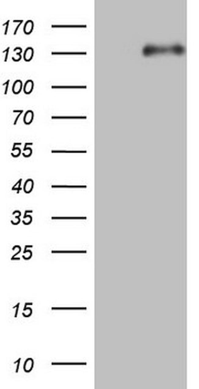 LPIN1 Antibody in Western Blot (WB)