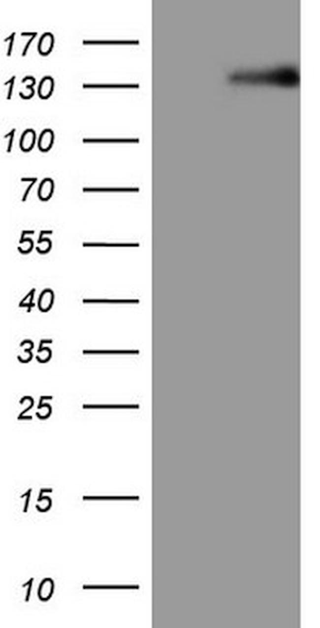 LPIN1 Antibody in Western Blot (WB)