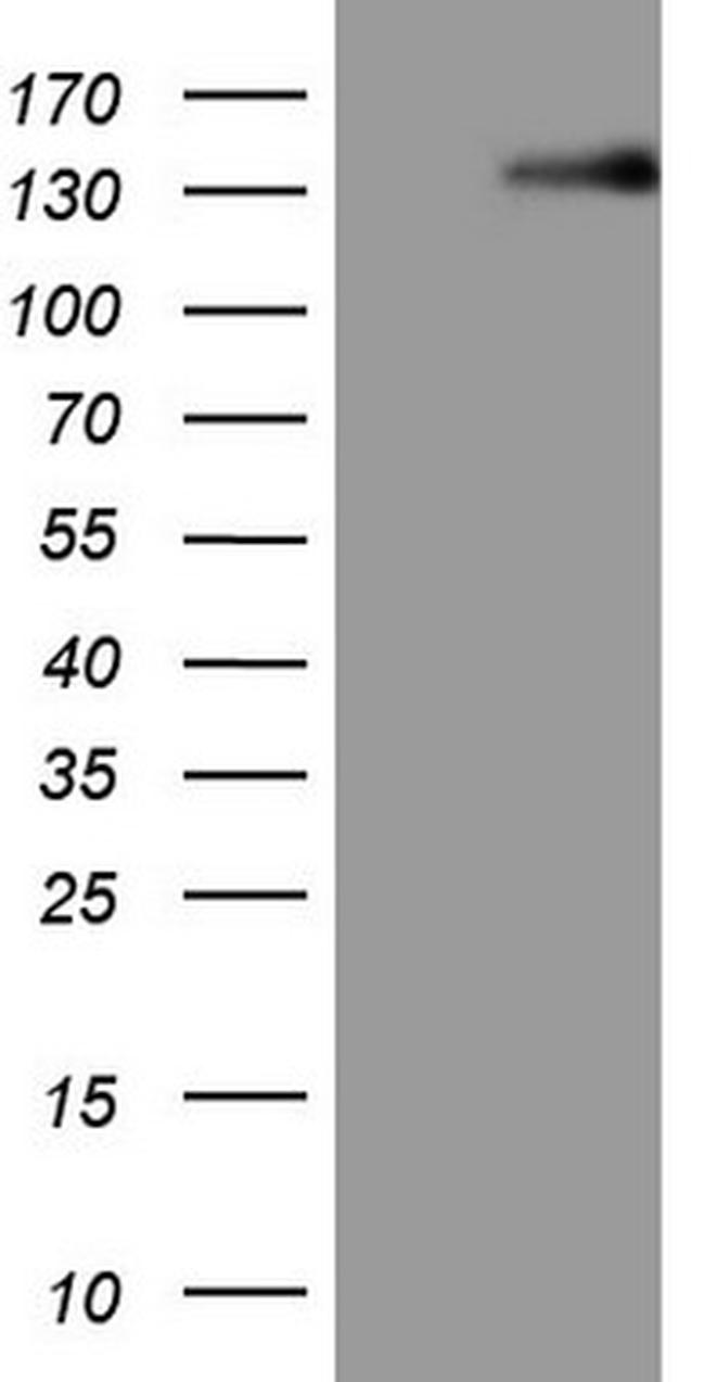 LPIN1 Antibody in Western Blot (WB)