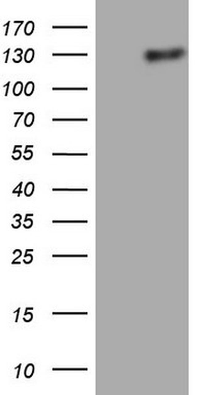 LPIN1 Antibody in Western Blot (WB)