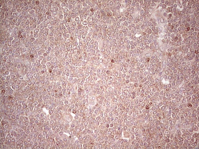 LPIN3 Antibody in Immunohistochemistry (Paraffin) (IHC (P))