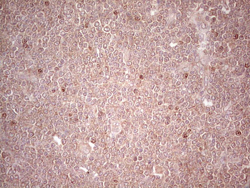 LPIN3 Antibody in Immunohistochemistry (Paraffin) (IHC (P))