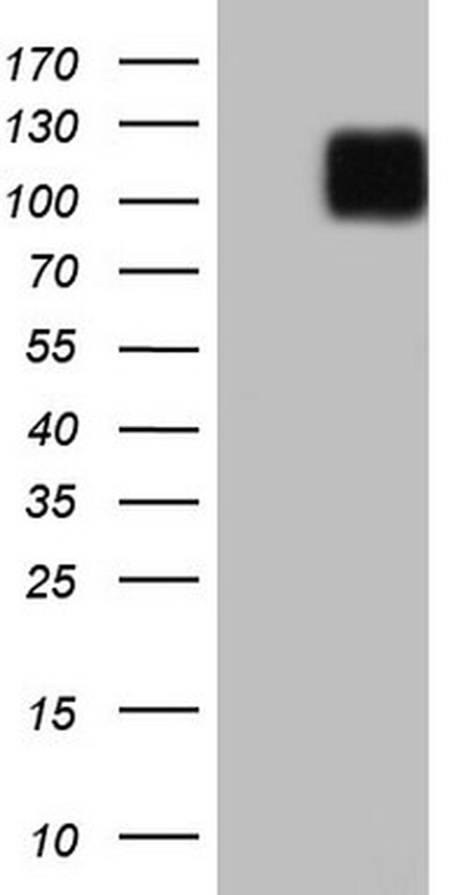 LPIN3 Antibody in Western Blot (WB)