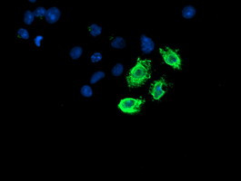 LPL Antibody in Immunocytochemistry (ICC/IF)