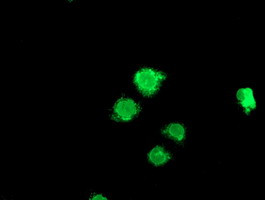 LPL Antibody in Immunocytochemistry (ICC/IF)