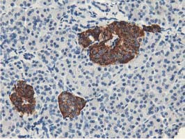 LPL Antibody in Immunohistochemistry (Paraffin) (IHC (P))