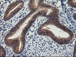LPL Antibody in Immunohistochemistry (Paraffin) (IHC (P))