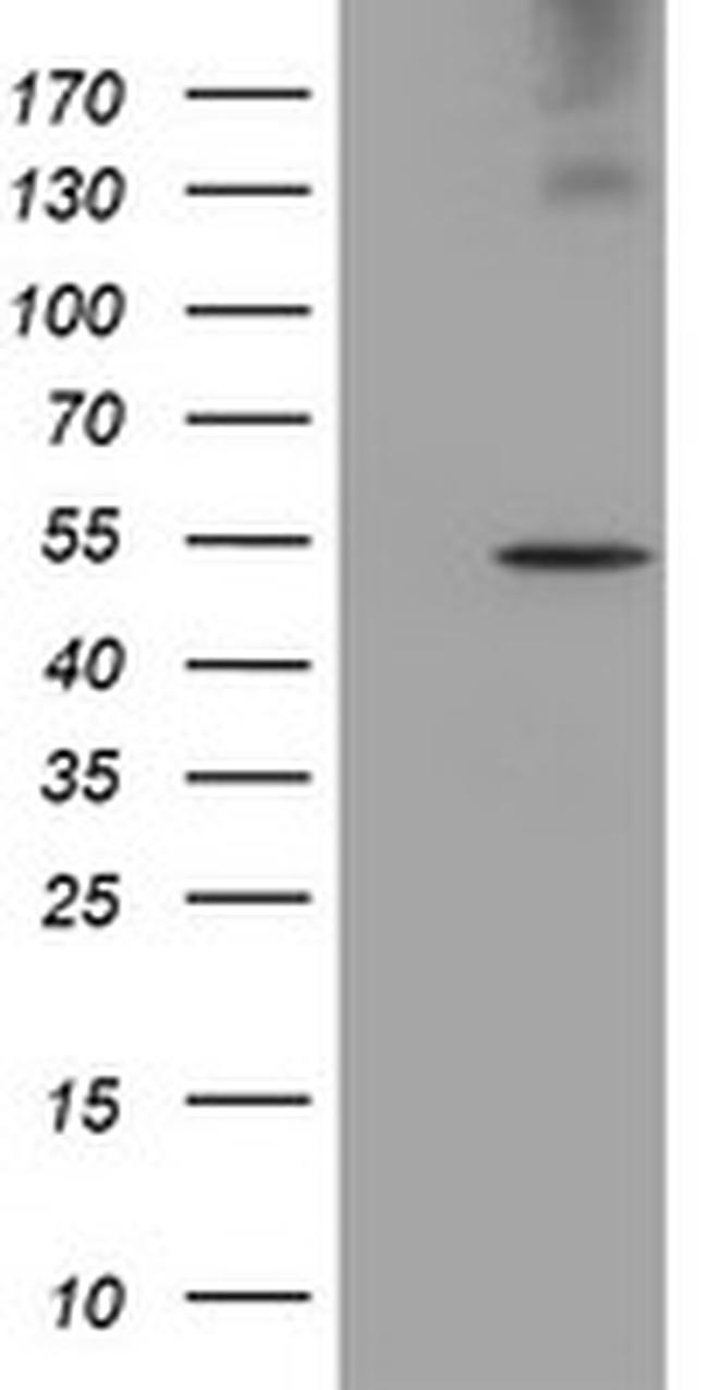 LPL Antibody in Western Blot (WB)