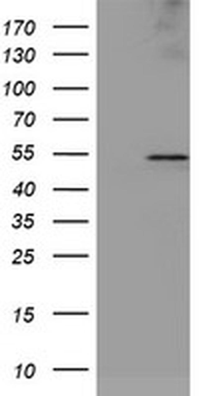 LPL Antibody in Western Blot (WB)