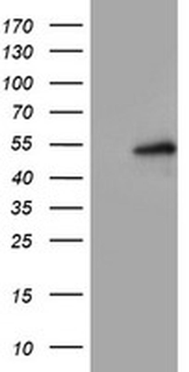 LPL Antibody in Western Blot (WB)