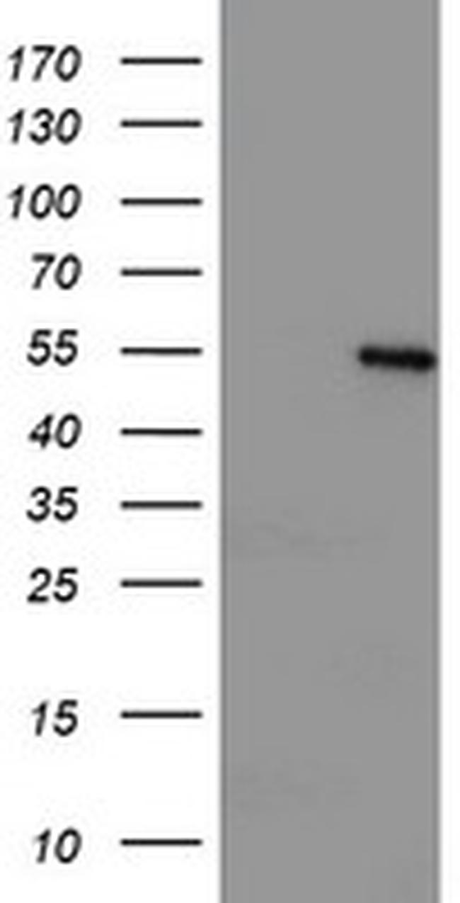 LPL Antibody in Western Blot (WB)